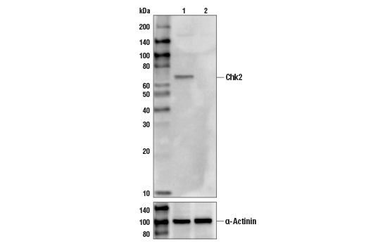 Western Blotting Image 1: Chk2 (1C12) Mouse mAb (BSA and Azide Free)