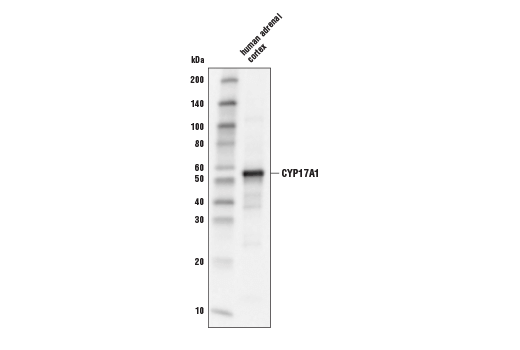 Western Blotting Image 1: CYP17A1 Antibody