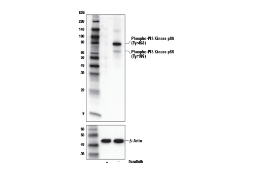 Western Blotting Image 1: Phospho-PI3 Kinase p85 (Tyr458)/p55 (Tyr199) (E3U1H) Rabbit mAb