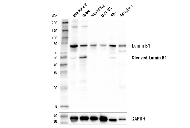  Image 3: Mouse Reactive Senescence Marker Antibody Sampler Kit