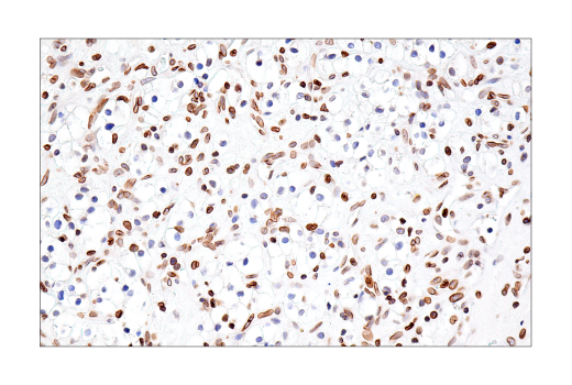  Image 36: Mouse Reactive Senescence Marker Antibody Sampler Kit
