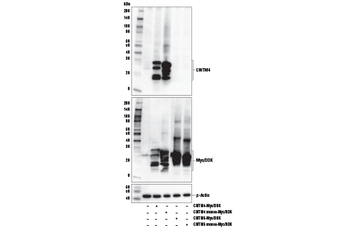 Western Blotting Image 2: CMTM4 Antibody
