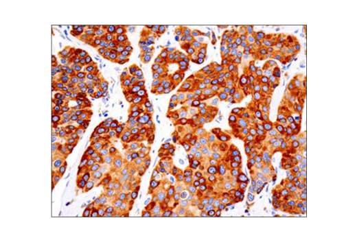 Immunohistochemistry Image 1: Bcl-2 (124) Mouse mAb (BSA and Azide Free)