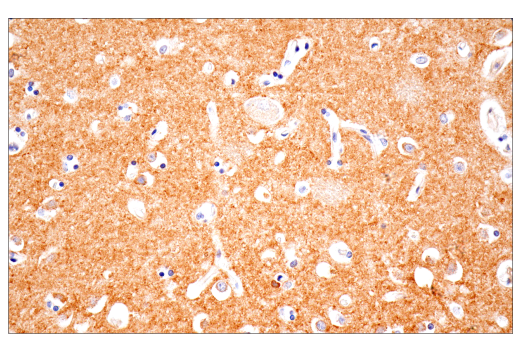 Immunohistochemistry Image 10: TPBG/5T4 (E3M5R) XP® Rabbit mAb
