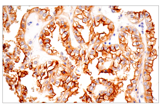 Immunohistochemistry Image 1: TPBG/5T4 (E3M5R) XP® Rabbit mAb