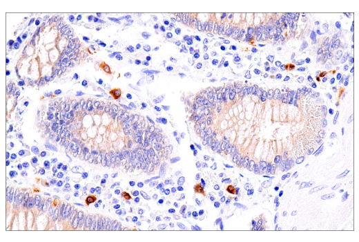Immunohistochemistry Image 6: Rab27B (E4V3O) Rabbit mAb