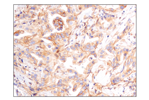 Immunohistochemistry Image 2: Notch2 (D76A6) XP® Rabbit mAb (BSA and Azide Free)