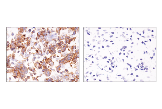 Immunohistochemistry Image 3: Notch2 (D76A6) XP® Rabbit mAb (BSA and Azide Free)