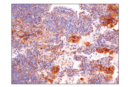 Immunohistochemistry Image 5: Notch2 (D76A6) XP® Rabbit mAb (BSA and Azide Free)