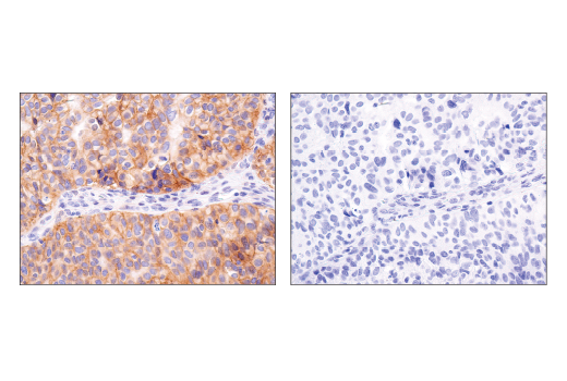 Immunohistochemistry Image 7: Notch2 (D76A6) XP® Rabbit mAb (BSA and Azide Free)