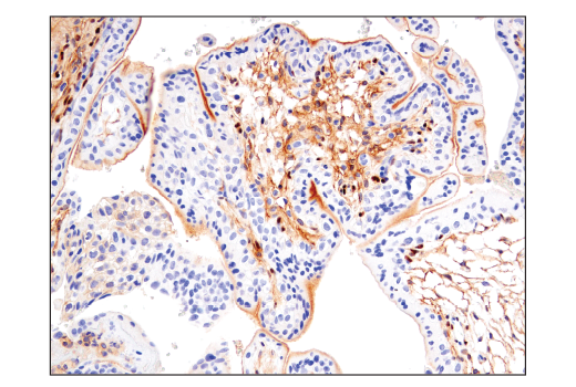 Immunohistochemistry Image 8: Notch2 (D76A6) XP® Rabbit mAb (BSA and Azide Free)