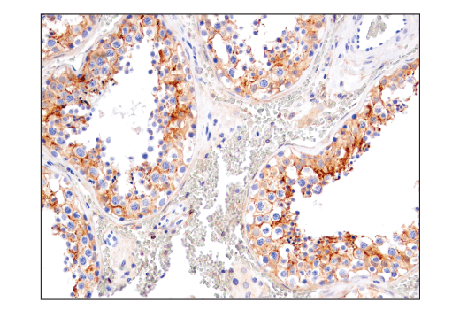 Immunohistochemistry Image 9: Notch2 (D76A6) XP® Rabbit mAb (BSA and Azide Free)