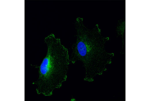 Immunofluorescence Image 1: Notch2 (D76A6) XP® Rabbit mAb (BSA and Azide Free)