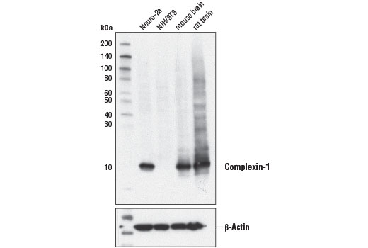 Western Blotting Image 1: Complexin-1 (D5Q5H) Rabbit mAb
