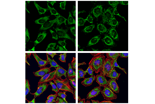Immunofluorescence Image 1: G3BP1 Antibody