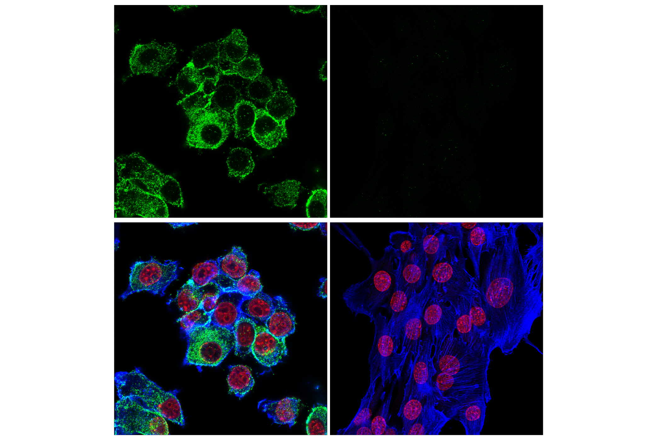 Immunofluorescence Image 3: CD11b/ITGAM (E6E1M) Rabbit mAb