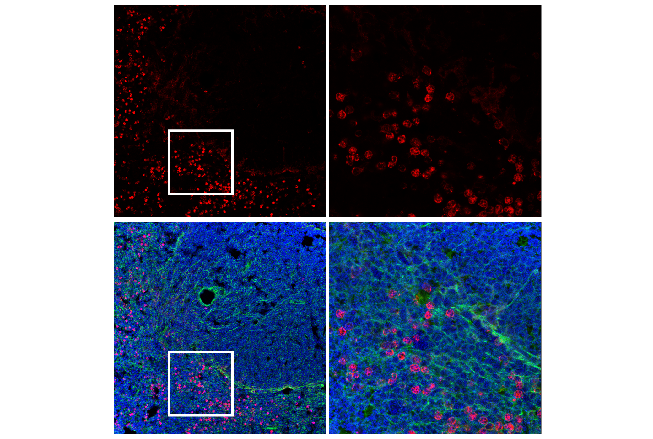Immunofluorescence Image 2: CD11b/ITGAM (E6E1M) Rabbit mAb