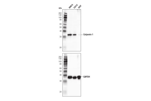 Western Blotting Image 1: Calponin 1 (D8L2T) XP® Rabbit mAb