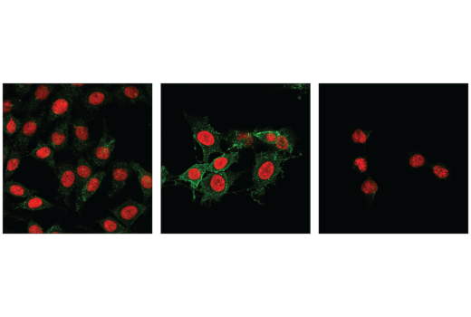 Immunofluorescence Image 1: Phospho-MLKL (Ser345) (D6E3G) Rabbit mAb (BSA and Azide Free)