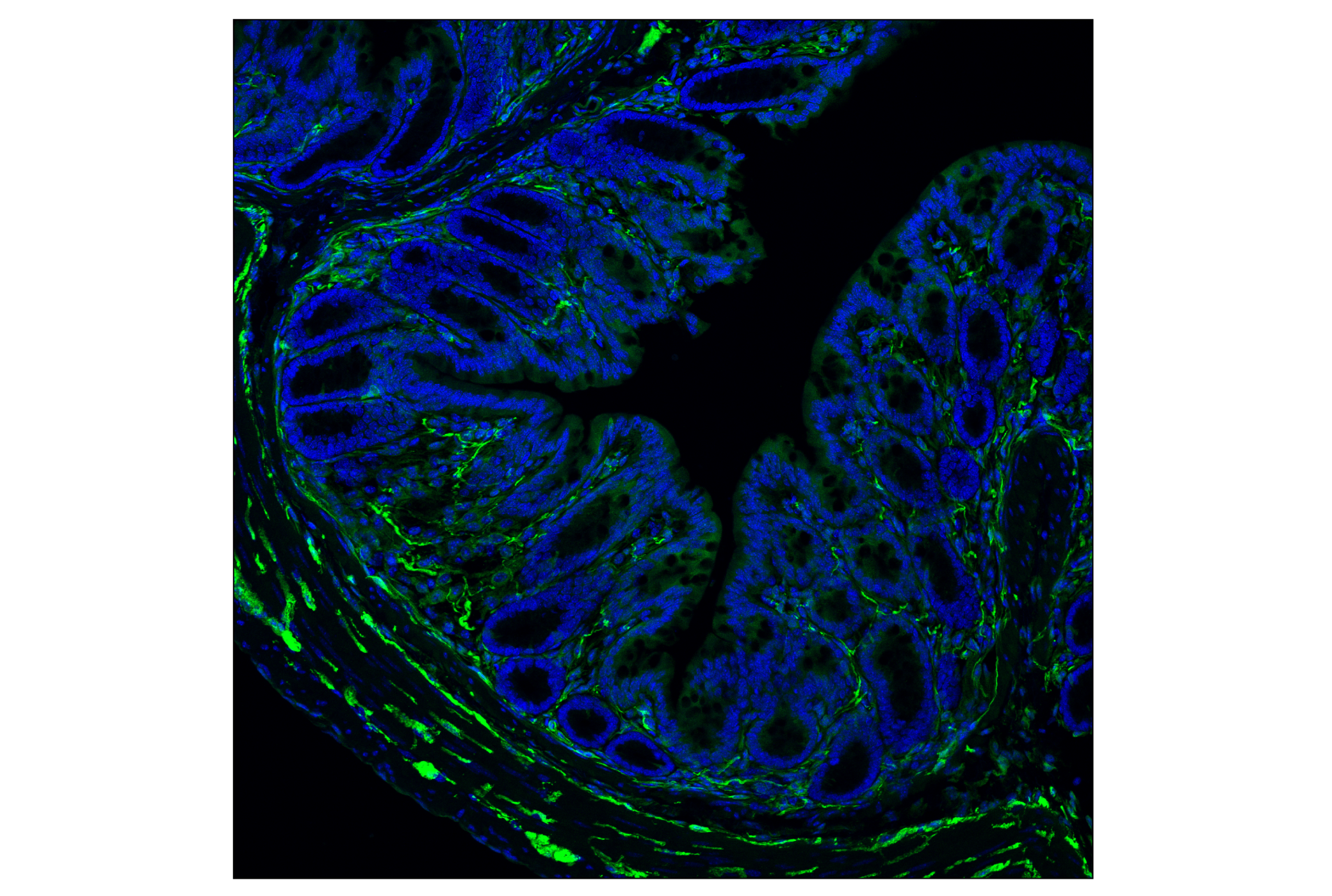 Immunofluorescence Image 3: TPPP/p25 (E9C8G) Rabbit mAb