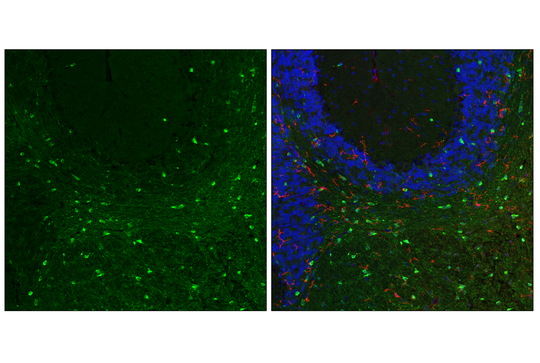 Immunofluorescence Image 2: TPPP/p25 (E9C8G) Rabbit mAb