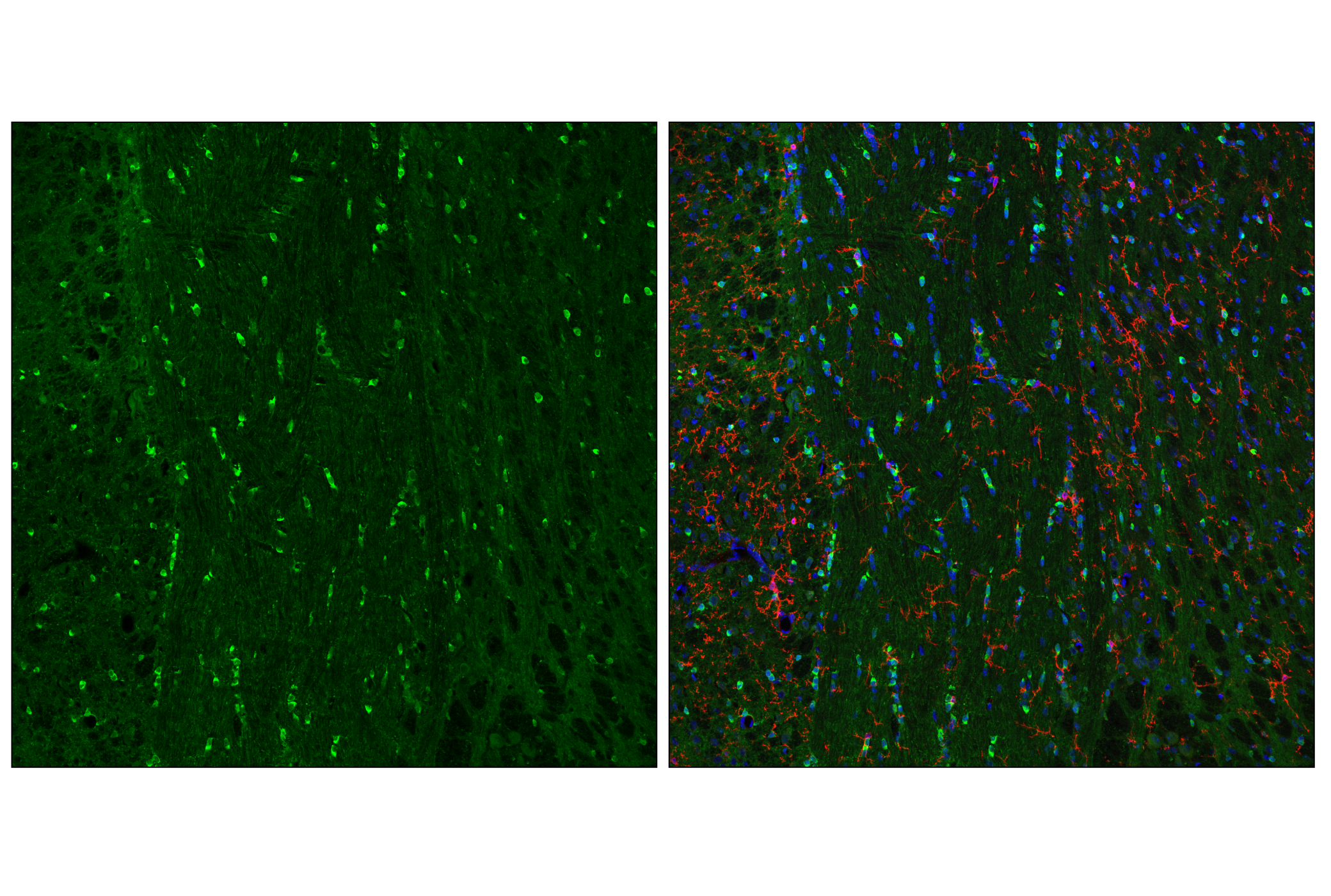 Immunofluorescence Image 1: TPPP/p25 (E9C8G) Rabbit mAb