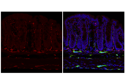 Immunofluorescence Image 3: CD68 (E3O7V) Rabbit mAb (Alexa Fluor® 647 Conjugate)