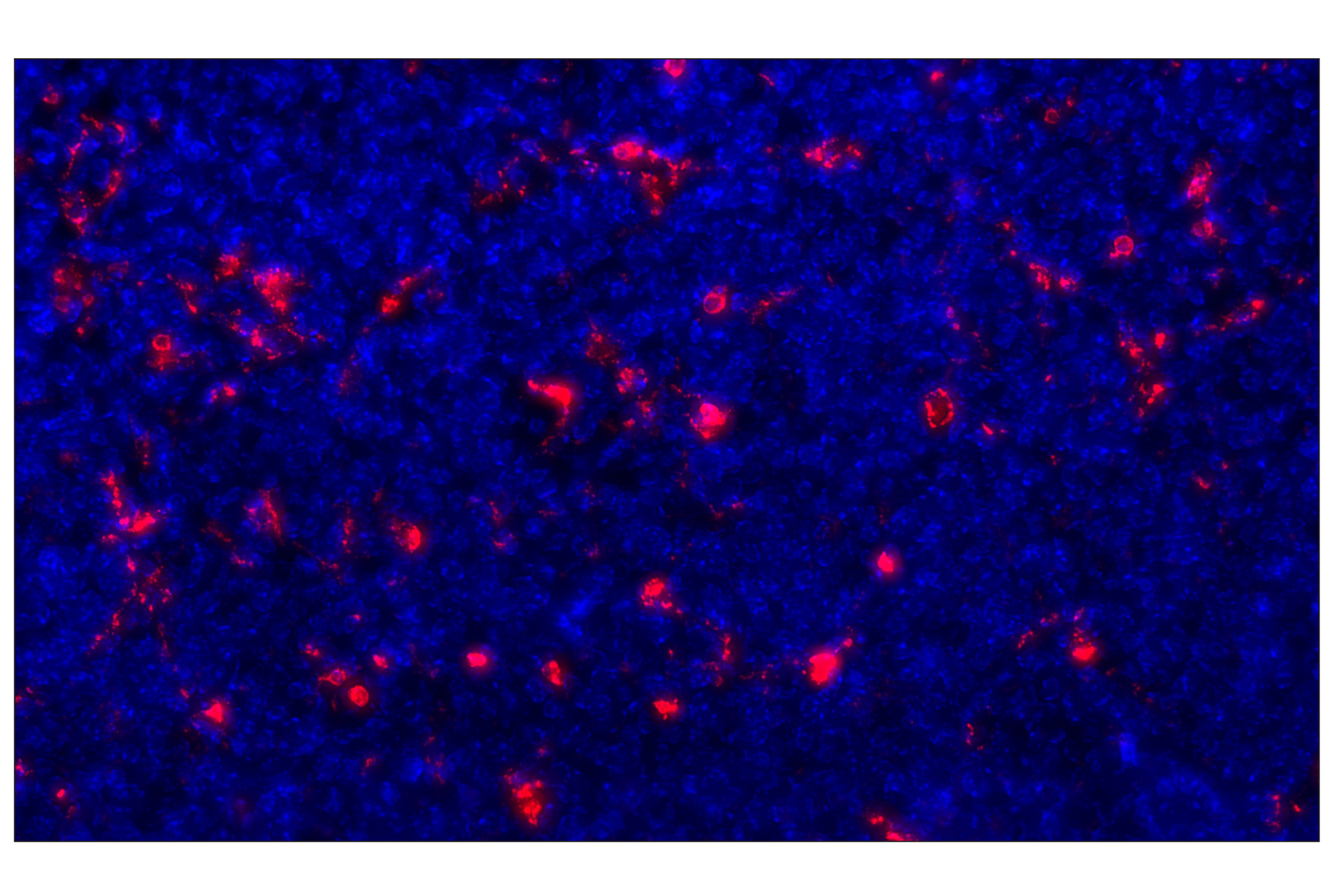Immunohistochemistry Image 2: CD68 (E3O7V) Rabbit mAb (Alexa Fluor® 647 Conjugate)