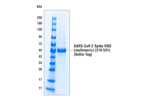  Image 3: SARS-CoV-2 Spike RBD (multimeric) (319-591) Recombinant Protein (8xHis-Tag)