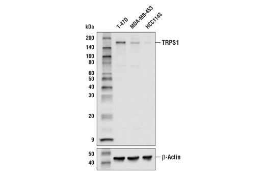 Western Blotting Image 1: TRPS1 Antibody