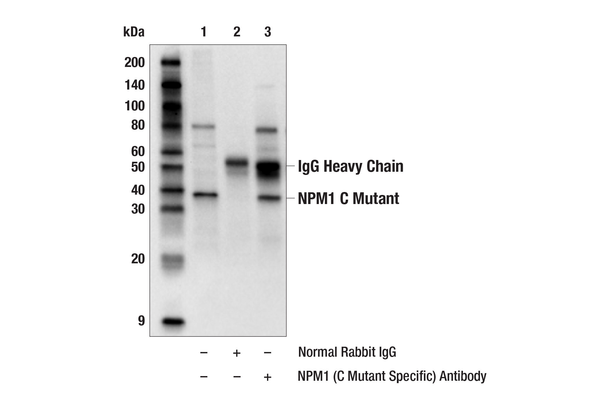 Immunoprecipitation Image 1: NPM1 (C Mutant Specific) Antibody
