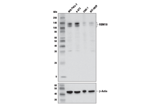 Western Blotting Image 1: RBM10 Antibody