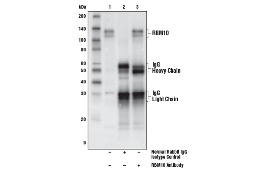Immunoprecipitation Image 1: RBM10 Antibody