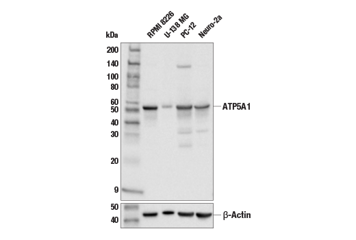 Western Blotting Image 1: ATP5A1 Antibody