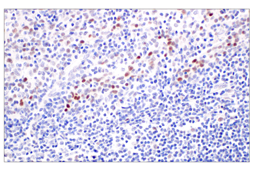 Immunohistochemistry Image 6: p53 (DO-1) Mouse mAb