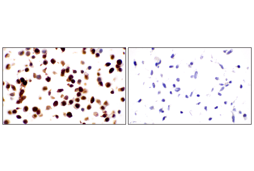 Immunohistochemistry Image 8: p53 (DO-1) Mouse mAb