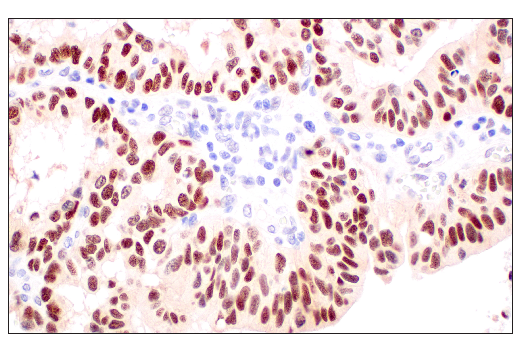 Immunohistochemistry Image 5: p53 (DO-1) Mouse mAb