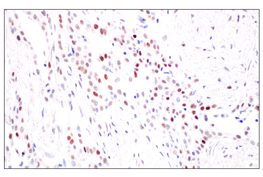 Immunohistochemistry Image 3: p53 (DO-1) Mouse mAb