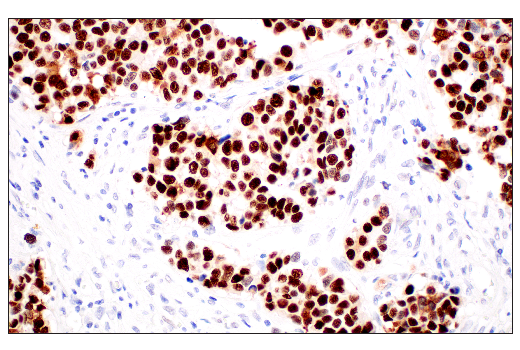 Immunohistochemistry Image 1: p53 (DO-1) Mouse mAb