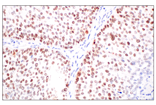 Immunohistochemistry Image 2: p53 (DO-1) Mouse mAb
