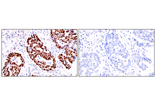 Immunohistochemistry Image 7: p53 (DO-1) Mouse mAb