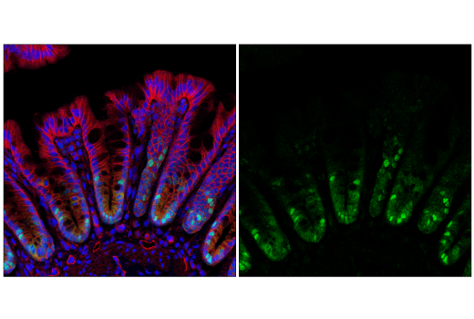 Immunofluorescence Image 1: CDK2 (E8J9T) XP® Rabbit mAb