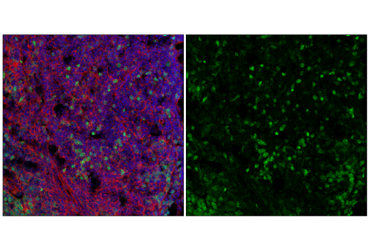 Immunofluorescence Image 2: CDK2 (E8J9T) XP® Rabbit mAb