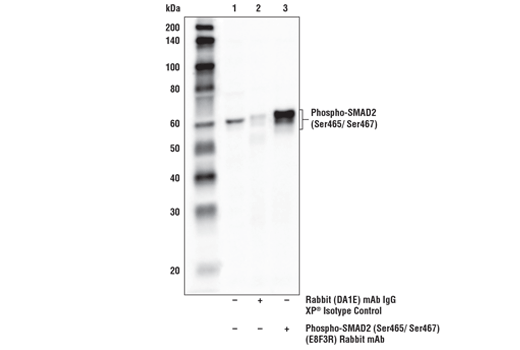 Immunoprecipitation Image 1: Phospho-SMAD2 (Ser465/Ser467) (E8F3R) Rabbit mAb