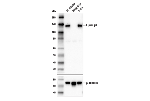 Western Blotting Image 1: Liprin β1 Antibody