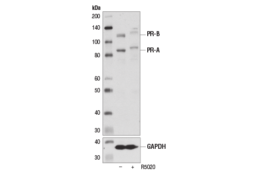 Western Blotting Image 2: Progesterone Receptor A/B (D8Q2J) XP® Rabbit mAb (BSA and Azide Free)