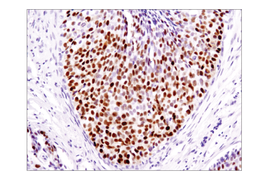 Immunohistochemistry Image 1: Progesterone Receptor A/B (D8Q2J) XP® Rabbit mAb (BSA and Azide Free)