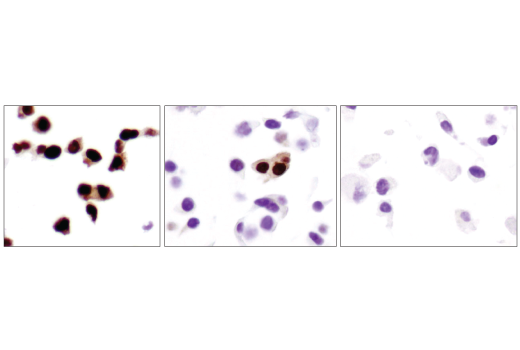 Immunohistochemistry Image 2: Progesterone Receptor A/B (D8Q2J) XP® Rabbit mAb (BSA and Azide Free)