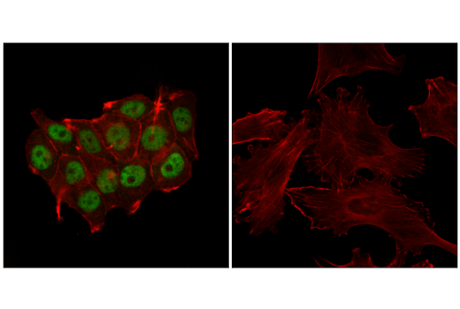 Immunofluorescence Image 1: Progesterone Receptor A/B (D8Q2J) XP® Rabbit mAb (BSA and Azide Free)
