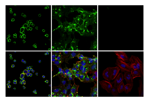 Immunofluorescence Image 1: TNFRSF8/CD30 (E7E4D) XP® Rabbit mAb (BSA and Azide Free)